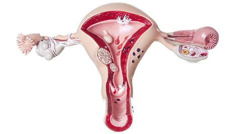 Cáncer De Cuello Uterino Cómo Prevenir Una Enfermedad Que No Suele Presentar Síntomas Infobae