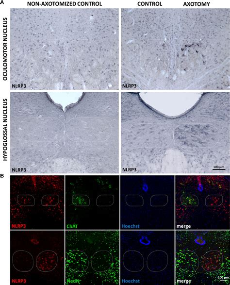 Frontiers Upregulation Of Nucleotide Binding Oligomerization Domain