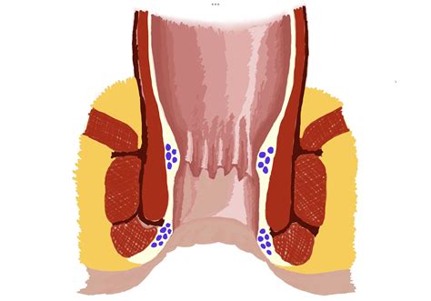 Understanding Anal Fissures Anatomy Symptoms And Treatments Dr