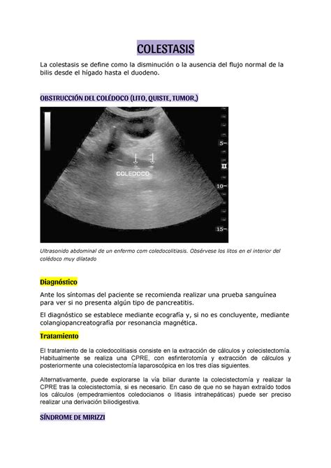 Colestasis Colestasis La Colestasis Se Define Como La Disminución O