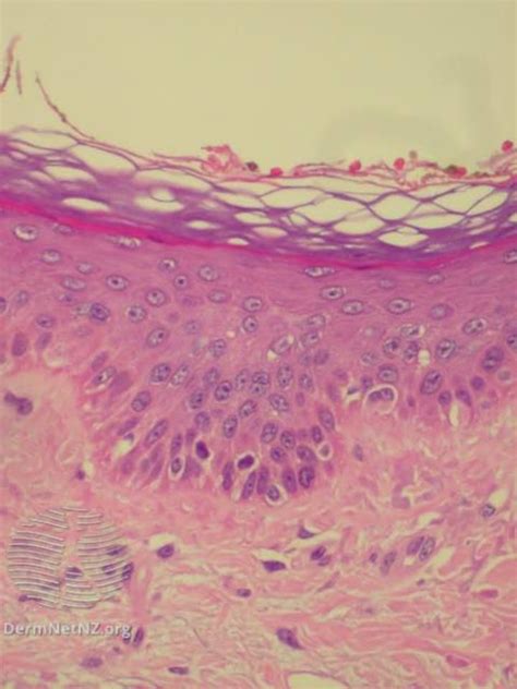 Hypodermis (Subcutaneous Tissue): Anatomy and Function