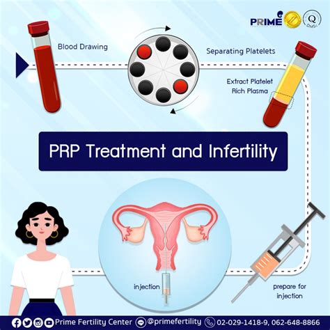 Prp Treatment And Infertility Thailand Ivf Icsi Iui