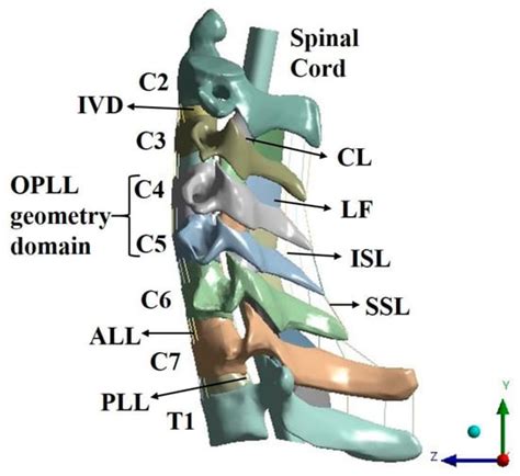 Bioengineering Free Full Text Stress Distribution On Spinal Cord