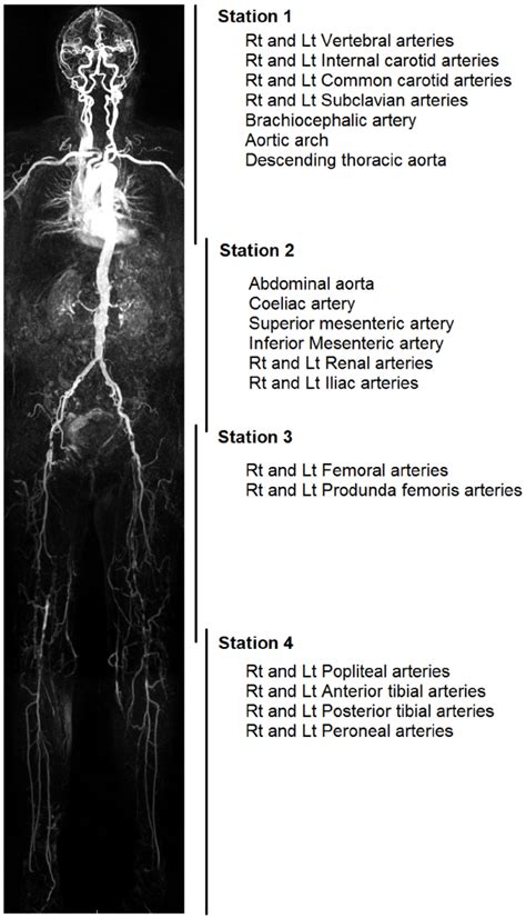 Diagram Of The Whole Body Magnetic Resonance Angiography Stations And