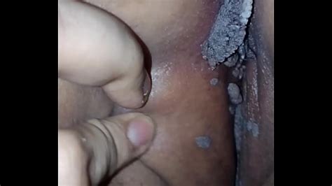 Hpv Human Papilloma Virus Stds Xxx Mobile Porno Videos And Movies