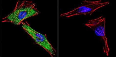 Glucocorticoid Receptor Polyclonal Antibody Invitrogen G