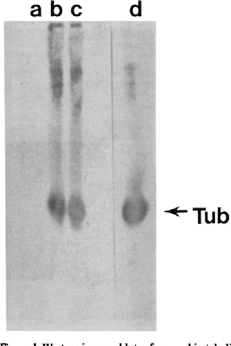 Figure 1 From Posttranslational Modification And Microtubule Stability