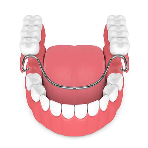 removable dentures  spring tx  woodlands