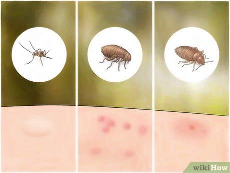 How To Identify Insect Bites 15 Steps With Pictures WikiHow