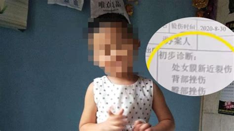 哈尔滨4岁女童疑被邻居侵犯 至今仍在icu救治手机新浪网