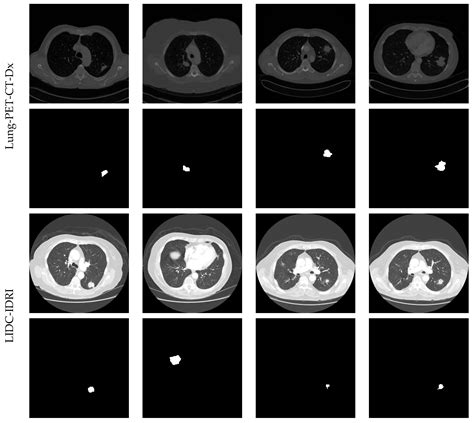 Diagnostics Free Full Text Vgg19 Network Assisted Joint Segmentation And Classification Of