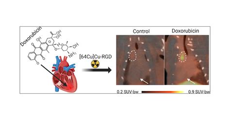 Early Detection Of Cardiotoxicity Using Cu Cu Nodaga E Crgdyk