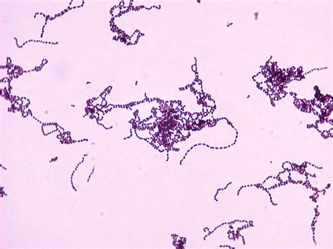 Streptococcus Agalactiae Gram Stain