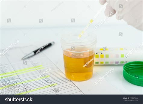 Check Routine Urinalysis Reagent Strip Urinalysis Stock Photo