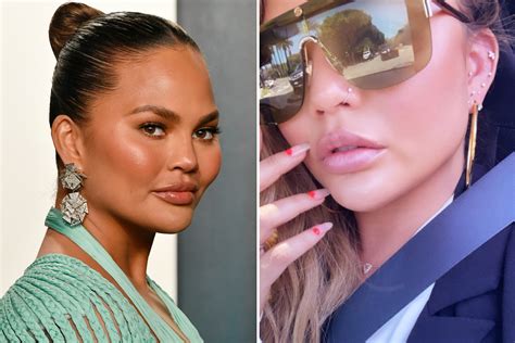 Chrissy Teigen Says You Only Live Once In New Selfie After Model Receives Backlash For