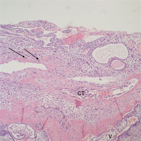 Chapter Placental Perfusion Section A Spiral Arteries Obstetrical