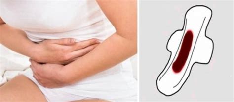 Arroto Choco O Que É - Arroto Choco: por que ocorre e como evitar
