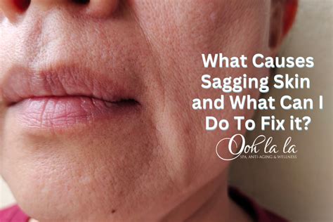 What Causes Sagging Skin And What Can I Do To Fix It Ooh La La Spa