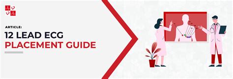 12-Lead ECG Placement Guide - CardiacDirect