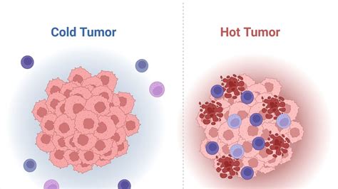 Breakthrough In Immunotherapy Cold Tumors Harbor Cancer Fighting T