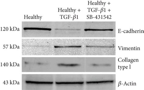 Effects Of Sb Treatment On The Expression Of E Cadherin