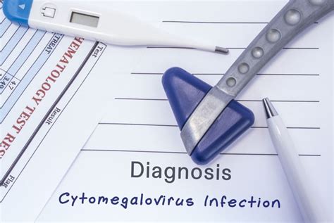 10 Symptoms of Cytomegalovirus (CMV) - Health & Detox & Vitamins