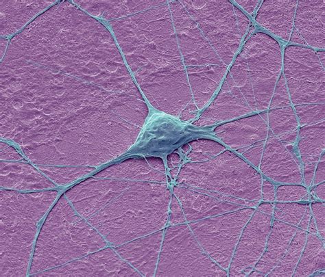 Motor Neurone Sem Stock Image C Science Photo Library