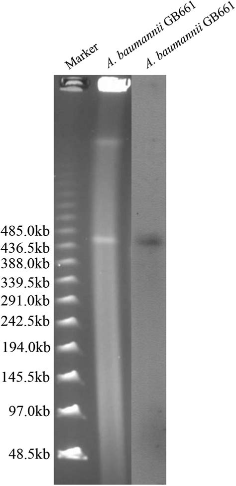 NDM 1 Producing Citrobacter Freundii Escherichia Coli And