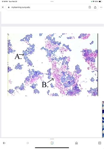 Speciality Staining Flashcards Quizlet