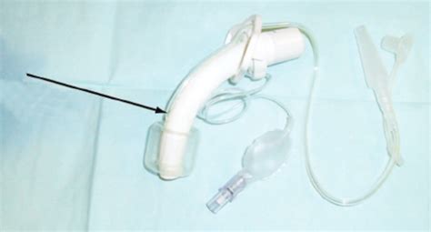 Tracheostomy Tube With A Suction Port Above The Cuff Download