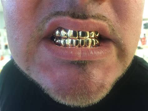 14k Solid Gold Grills With Deep Cutpermanent Looking 6 Top Custom Fit