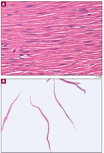 Practical Bio Muscle Histology Flashcards Quizlet