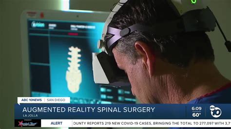 Augmented Reality Spinal Surgery Debuts At Ucsd Health