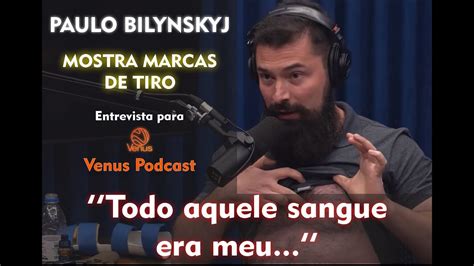 Paulo Bilynskyj Fala Sobre Morte De Ex E Mostra Marcas De Tiro