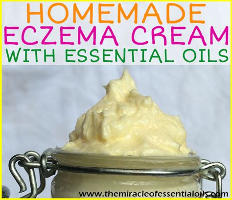 DIY Essential Oil Eczema Cream - The Miracle of Essential Oils