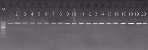 Electrophoresis of DNA extraction results. | Download Scientific Diagram