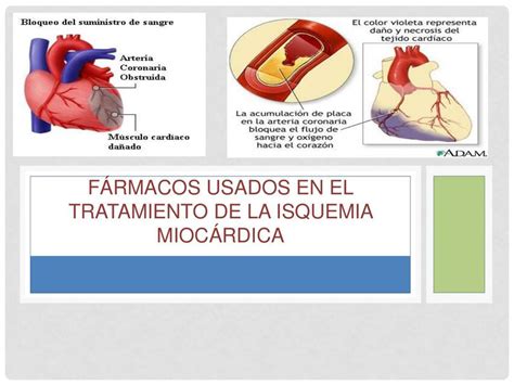 F Rmacos Usados En El Tratamiento De La Isquemia Mioc Rdica Licda