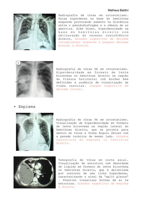 Solution Tabela De Todas As Descri Es De Radiologia Torax Abdome