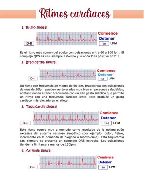 Ritmos Cardíacos Electrocardiograma Cardiología Udocz