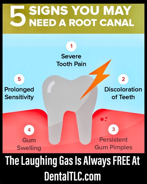 Signs You May Need A Root Canal Dental Tlc