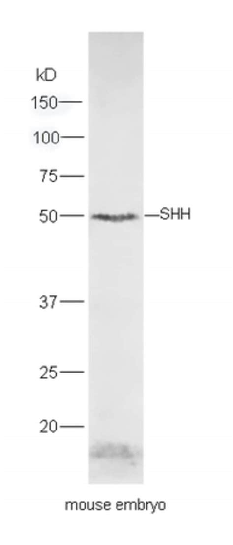 Shh Rabbit Anti Human Polyclonal Bioss L Unconjugated