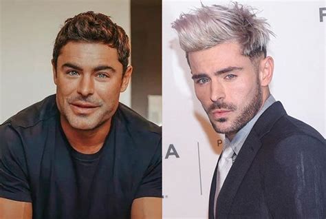 Zac Efron Défiguré Par La Chirurgie Visage Transformé… Il Explique Les