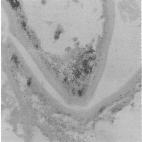 Gram stain of Propionibacterium acnes showing variably staining Gram... | Download Scientific ...