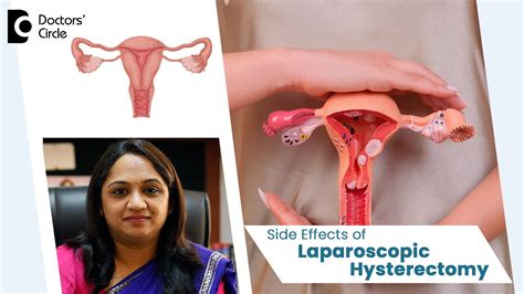 Laparoscopic Hysterectomy Safety And Side Effects Womenshealth Dr