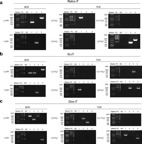 Pcr Bands Of B Cell Specific Bcr Igh V D J Rearrangements And T