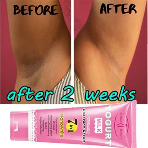 Armpit Whitening Cream Underarm Whitening Pampaputi Ng Kili Kili