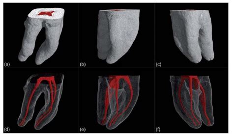 Patient Education Scripps Mesa Endodontics