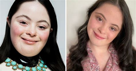 18 Year Model Model With Down Syndrome Stars In Guccis New Beauty Campaign 18 Year Model Model