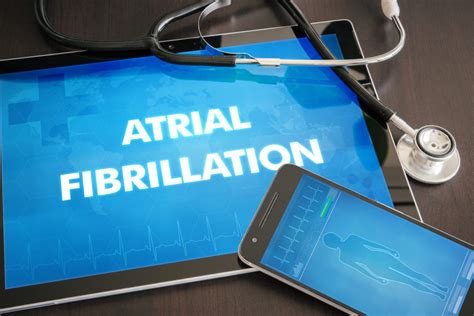 The Most Common Signs And Symptoms Of Atrial Fibrillation The Pk Times