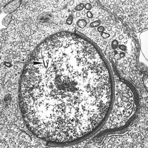 Transmission Electron Micrographs Of Testicular Sections From A 61 Week